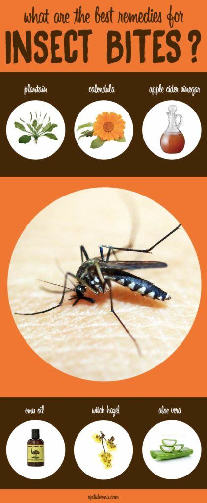 Natural Remedies for Bug Bites