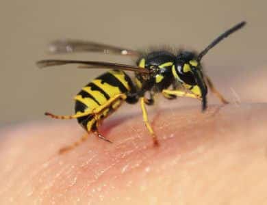 Bee, Wasp, or Hornet Sting